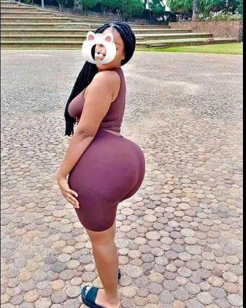 Hydrogel injections to increase buttocks size in Durban+27 74 676 7021