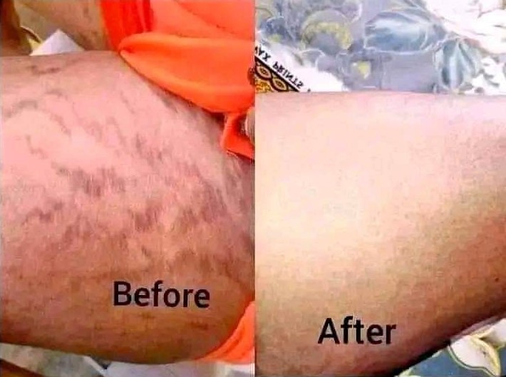 Skin care products for pimples ,dark spots in Randfontein , Siyabuswa , Somerset East+27 81 850 2816