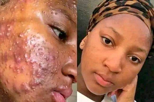 BEAUTY CLINIC FOR BEST SKIN CARE PRODUCTS IN CAPE TOWN+27 81 850 2816
