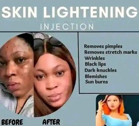 Skin whitening products in Mafikeng, Gaborone,Botswana+27 81 850 2816