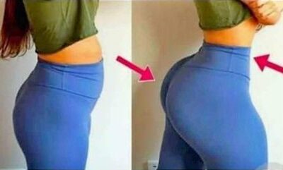 Hydrogel injections to increase buttocks size in Durban+27 74 676 7021