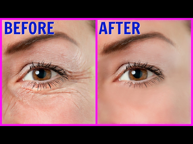 Wrinkles Reduction and Skin Rejuvenation In Mbombela,Pietermaritzburg+27 81 850 2816