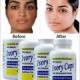 Skin care products for Acne, Scars, blackheads, whiteheads in Randburg, Sasolburg, vanderbiljpark+27 81 850 2816